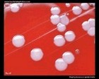 Staphy.epidermidis on blood agar